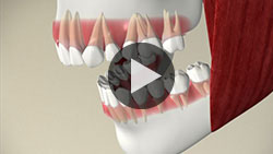 Orthodontics Overview